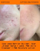 Glow Hub The Scar Slayer élénkítő szérum a pigment foltok ellen 30 ml