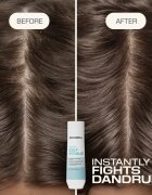 Goldwell Dualsenses Scalp Specialist Anti-Dandruff Shampoo korpásodás elleni sampon 250 ml