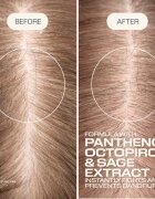 Goldwell Dualsenses Scalp Specialist Anti-Dandruff Shampoo korpásodás elleni sampon 250 ml