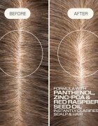 Goldwell Dualsenses Scalp Specialist Clarifying Shampoo mélyen tisztító sampon 1000 ml