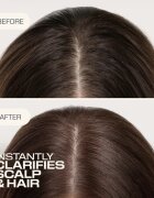 Goldwell Dualsenses Scalp Specialist Clarifying Shampoo mélyen tisztító sampon 250 ml
