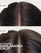 Goldwell Dualsenses Scalp Specialist Rebalance & Hydrate Fluid hidratáló fluid a fej bőrsejtjeinek megújítására 150 ml