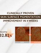 Haruharu Wonder Centella 5% Niacinamide Radiance Gel Cream gyengéd géles krém egységesíti a bőrszín tónusait 40 g