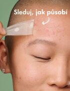 Hero Cosmetics Mighty Patch XL tapasz problémás bőrre 10 db