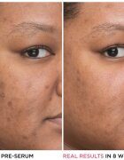 IT Cosmetics Bye Bye Dark Spots élénkítő korrekciós szérum a pigmentfoltok ellen niacinamiddal hölgyeknek 30 ml