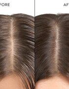 KERASILK Specialists Exfoliating Scalp & Hair Treatment sampon előtti ápolás hámlasztó hatással 200 ml