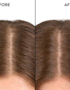 KERASILK Specialists Moisturizing Scalp Drops cseppek a száraz és érzékeny fejbőrre 100 ml