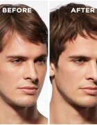 Kérastase Genesis Homme Sérum Anti-chute Fortifiant erősítő szérum kihullásra hajlamos legyengült hajra uraknak 90 ml