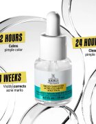 Kiehl's Dermatologist Solutions Truly Targeted Blemish-Clearing Solution szérum az aknés bőrre hölgyeknek 15 ml