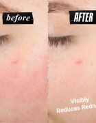 Kiehl's Ultra Facial Meltdown Recovery Cream könnyed regeneráló krém 50 ml