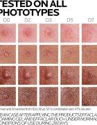 La Roche-Posay Effaclar szett problémás és pattanásos bőrre