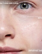 La Roche-Posay Effaclar Ultra tisztító micellás víz problémás és pattanásos bőrre 400 ml