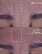 Lancôme Rénergie Collagen+ Lift-Xtend Cream bőrkrém kollagénnel 50 ml