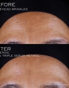 Lancôme Rénergie CRX Triple Serum Retinol bőr szérum 50 ml