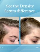 Living Proof Scalp Care szérum hajsűrűség fokozására 50 ml
