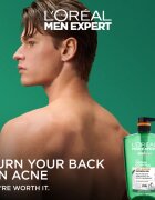 L’Oréal Paris Men Expert Derma Control tusfürdő gél érzékeny és problémás arcbőrre 1000 ml