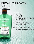 L’Oréal Paris Men Expert Derma Control tusfürdő gél érzékeny és problémás arcbőrre 1000 ml
