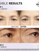 L’Oréal Paris Revitalift Filler arcápoló szett az arcra és a szem környékére