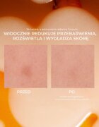 Lumene Nordic-C [VALO] Dark Spot Serum bőrélénkítő szérum C-vitaminnal a pigment foltok ellen 30 ml