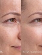 Mádara MÁDARA Kojic Alternative Pigment Serum szérum a pigment foltok ellen 30 ml