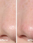 Mario Badescu 2-in-1 Deep Cleansing Pore Strip tapasz problémás bőrre 2 az 1-ben 6 db