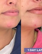 Mario Badescu Repairing Facial Spray With Hypochlorous Acid megújító spray arcra az arcbőr megnyugtatására 118 ml