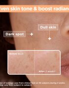 MIXA Anti-Dark Spot szérum a pigment foltok ellen 30 ml
