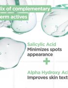 MIXA Anti-Imperfection Mattifying Gel mattító géles krém a bőr tökéletlenségei ellen 50 ml