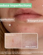 MIXA Anti-Imperfection szérum problémás és pattanásos bőrre 30 ml