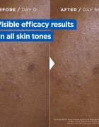 MIXA Niacinamide Bright intenzíven hidratáló krém a sötét foltok ellen 400 ml