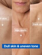 MIXA Niacinamide Bright intenzíven hidratáló krém a sötét foltok ellen 400 ml
