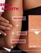 MIXA Urea Cica Repair+ regeneráló testkrém a nagyon száraz bőrre 150 ml