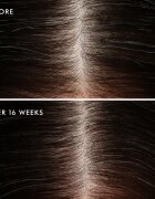 Moroccanoil Scalp Conditioner nyugtató kondicionáló zsíros fejbőrre korpásodás ellen 70 ml
