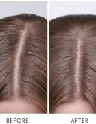 Moroccanoil Scalp Dry Scalp Treatment mélyen tápláló kúra száraz bőrre 45 ml