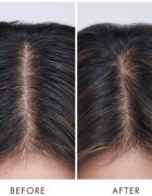 Moroccanoil Treatment Oily Scalp hajkúra zsíros fejbőrre 45 ml