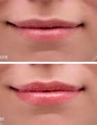 Notino Hydrating Sun Shield Lip Balm ajakvédő balzsam hidratáló hatással SPF 30 10 ml