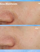 Origins Clear Improvement® Blackhead Clearing Mask-To-Scrub mitesszerek elleni pórustisztító maszk 75 ml