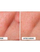 Perricone MD Cold Plasma Plus+ Advanced Serum tápláló szérum az arcra 30 ml