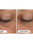 Perricone MD Cold Plasma Plus+ Eye Cream tápláló szemkrém a duzzanatokra és a sötét karikákra 15 ml
