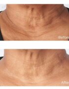 Perricone MD Cold Plasma Plus+ Sub-D/Neck feszesítő krém nyakra és dekoltázsra 59 ml