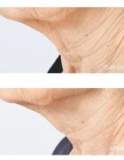 Perricone MD Cold Plasma Plus+ Sub-D/Neck feszesítő krém nyakra és dekoltázsra 59 ml