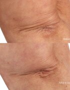 Perricone MD Essential Fx Acyl-Glutathione Chia Body Oil száraz testápoló olaj 118 ml