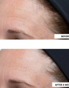 Perricone MD High Potency Classics Intensive Moisturizer intenzív hidratáló krém hialuronsavval 30 ml