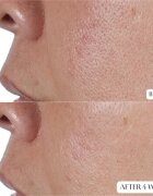 Perricone MD High Potency Face Finishing & Firming Toner feszesítő tonik 118 ml