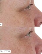 Perricone MD High Potency Night Moisturizer éjszakai krém a bőr feszességének megújítására 59 ml