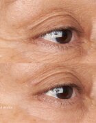 Perricone MD Hypoallergenic Clean Correction Eye Cream hidratáló és élénkítő ápolás a szemhéjakra és a szem körüli részekre 15 ml