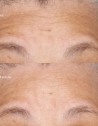 Perricone MD Hypoallergenic Clean Correction Moisturizer hidratáló és tápláló krém 59 ml