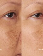 Perricone MD Hypoallergenic Clean Correction Moisturizer hidratáló és tápláló krém 59 ml