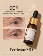 Perricone MD Neuropeptide Eyelid Lift Serum liftinges szérum a szem köré 15 ml