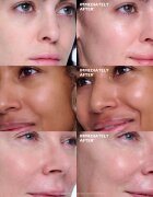 Peter Thomas Roth Collagen Skinjection™ Plumping & Firming Serum intenzíven feszesítő szérum kollagénnel 30 ml